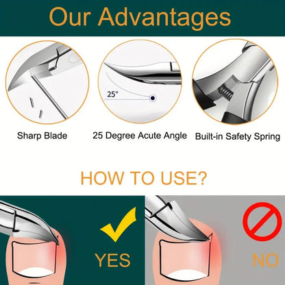 Ingrown Toenail Clippers Kit